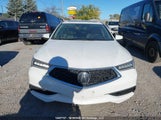 Acura Tlx 19UUB1F34JA800882 снимка