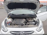 Hyundai Accent Gl KMHCT5AE5HU371683 снимка