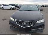 Acura Tlx Elite 19UUB3F72HA800064 снимка