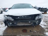 Hyundai Elantra Preferred Ivt With Sun And Tech Package KMHLM4AG1MU142789 fotografie