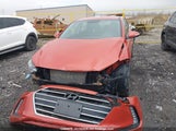 Hyundai Elantra KMHD84LF4HU112656 снимка