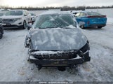 Hyundai Elantra Se 5NPD74LFXHH133285 снимка