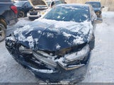 Acura Tlx Tech A-Spec 19UUB1F64LA800331 снимка
