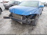 Hyundai Elantra Limited Ultimate KMHD84LF1HU125137 fotografie