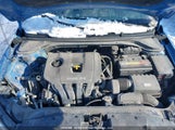 Hyundai Elantra KMHD84LF5HU425845 снимка