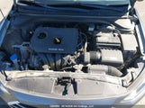 Hyundai Elantra Gl KMHD84LF4HU420846 снимка