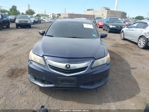 2014 ACURA ILX 2.0L (A5)