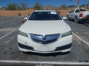 2017 ACURA TLX TECHNOLOGY PACKAGE