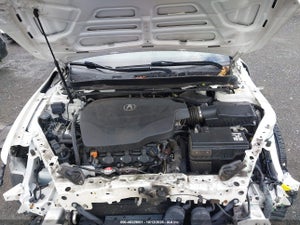 2017 ACURA TLX TECHNOLOGY PACKAGE