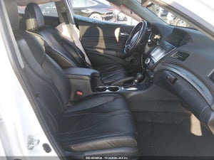 2020 ACURA ILX PREMIUM PACKAGE/TECHNOLOGY PACKAGE