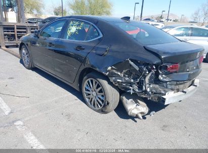 2017 ACURA TLX ADVANCE PACKAGE Black  Gasoline 19UUB3F77HA001798 photo #4