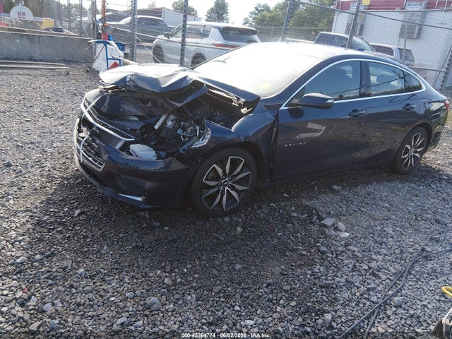 2017 Chevrolet MALIBU 1LT 缩略图 2