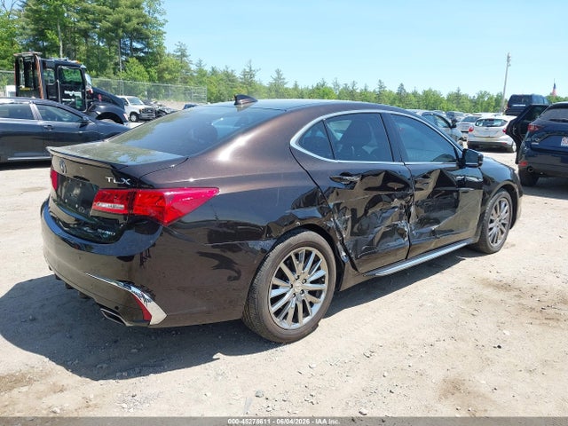 صورة 4 لـ 2018 Acura TLX ADVANCE PKG