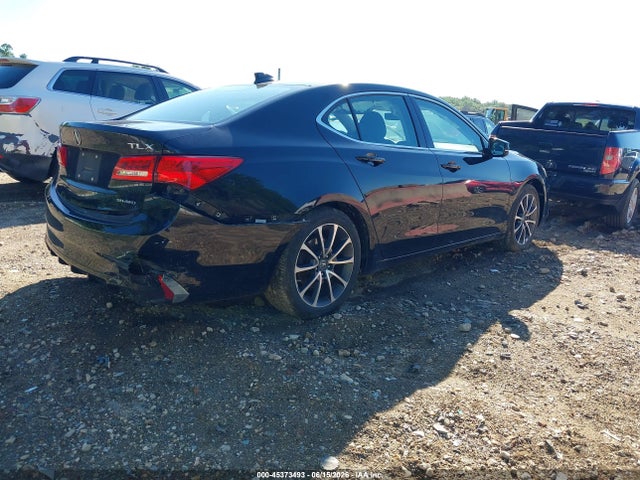 2018 Acura TLX 照片 4