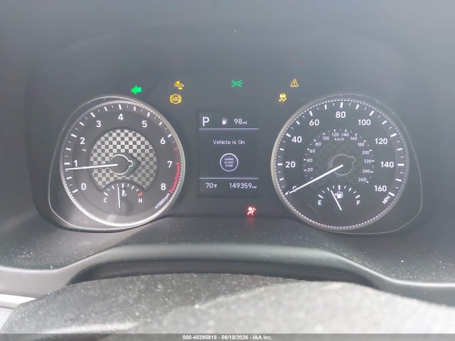 2020 Hyundai ELANTRA LIMITED — фото 7