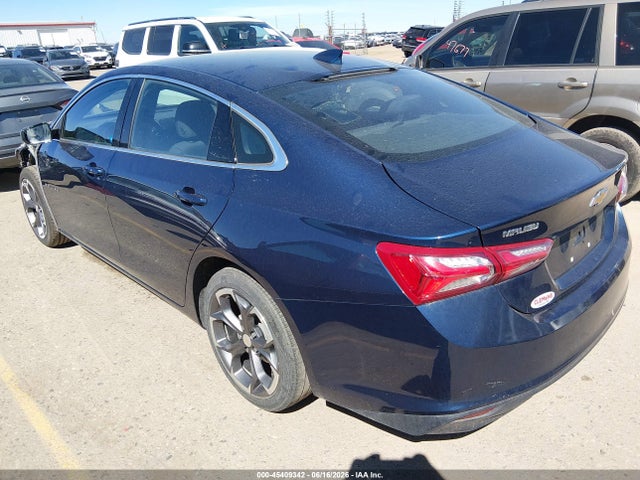 2022 Chevrolet MALIBU FWD LT — фото 3