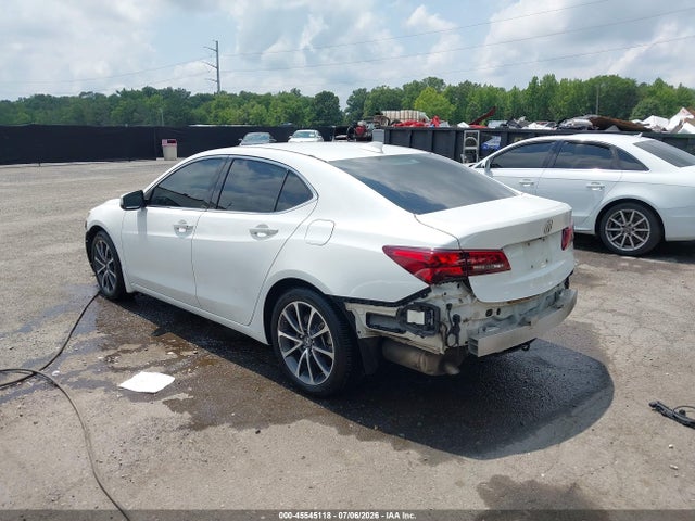 2015 Acura TLX V6 ADVANCE — фото 3