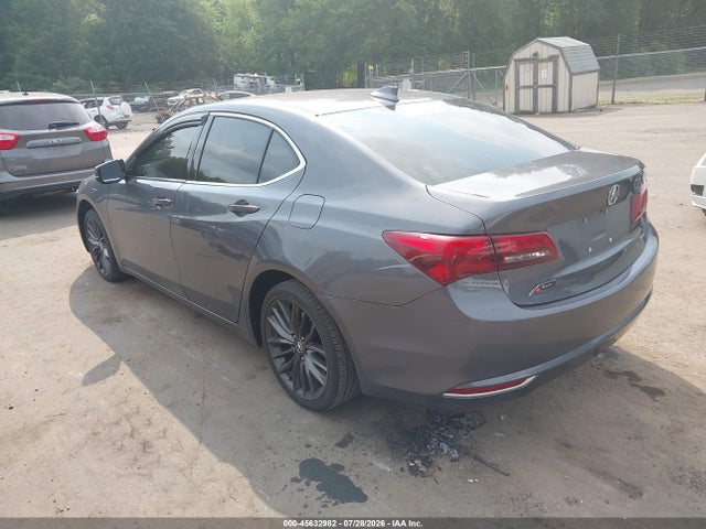 2017 Acura TLX TECHNOLOGY PACKAGE — фото 3