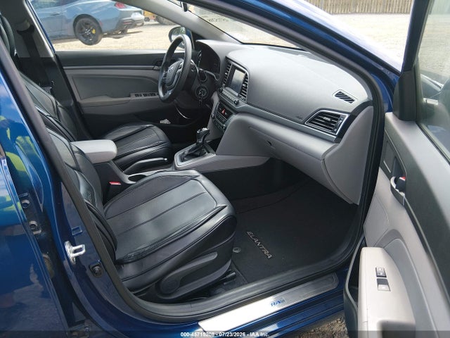 2018 Hyundai ELANTRA SEL 照片 5
