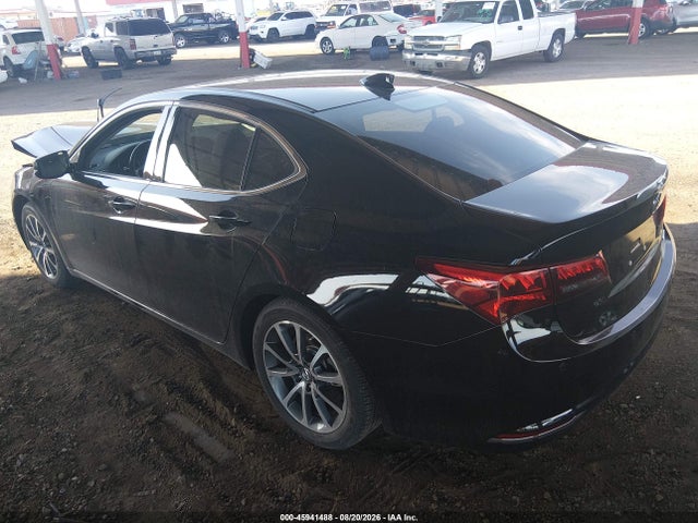 2017 Acura TLX ADVANCE PACKAGE — фото 3