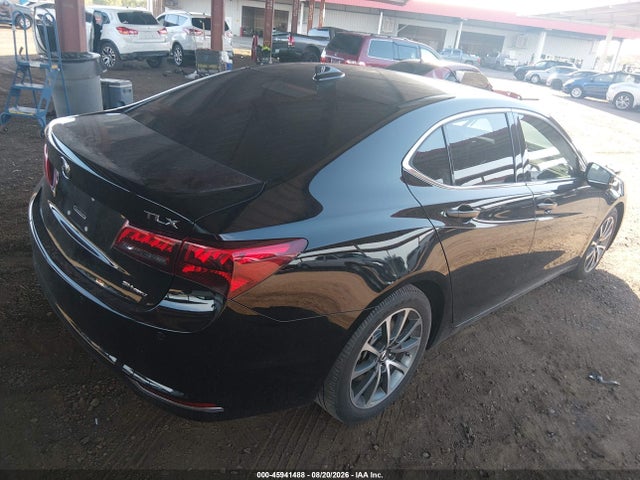 2017 Acura TLX ADVANCE PACKAGE — фото 4