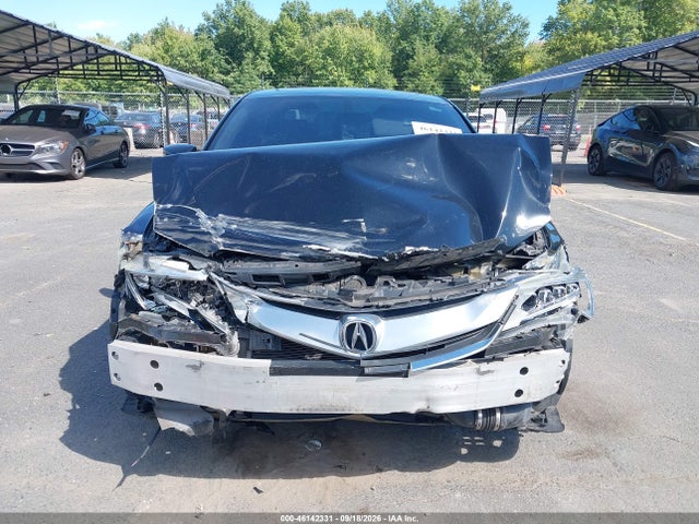 2017 ACURA ILX PREMIUM PACKAGE/TECHNOLOGY PLUS PACKAGE 13