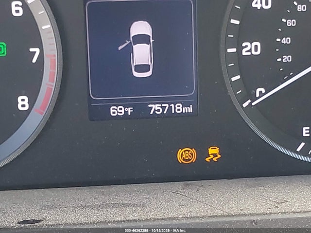 2017 HYUNDAI SONATA SPORT 15