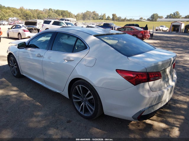 2020 ACURA TLX TECH PACKAGE 3