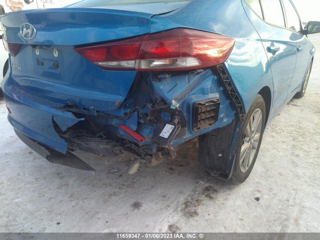 Hyundai Elantra 2017 KMHD84LF1HU379768 Image 7