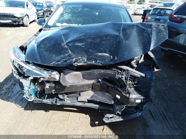 Hyundai ELANTRA SEL 2022 KMHLM4AG7NU360799 Image 6
