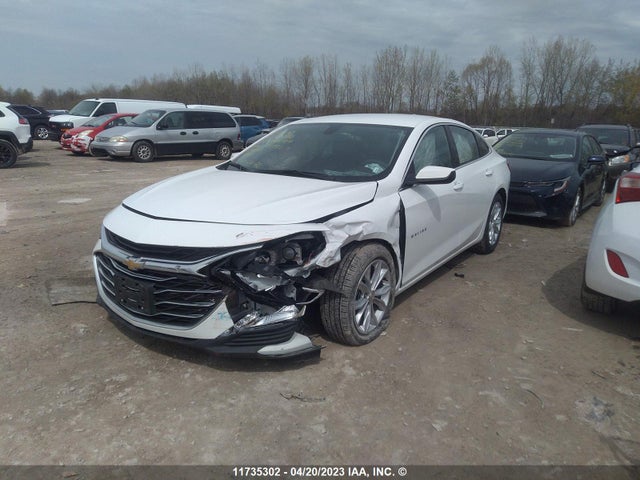 Chevrolet MALIBU LT 2022 1G1ZD5ST5NF177995 Image 2