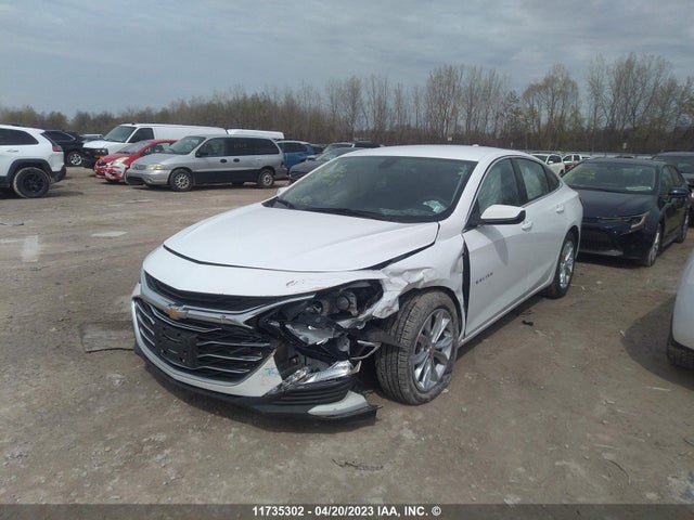Chevrolet MALIBU LT 2022 1G1ZD5ST5NF177995 Image 6