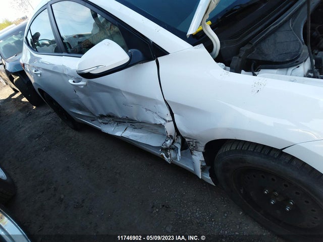 Hyundai ELANTRA GL 2017 KMHD84LF2HU307557 Image 6