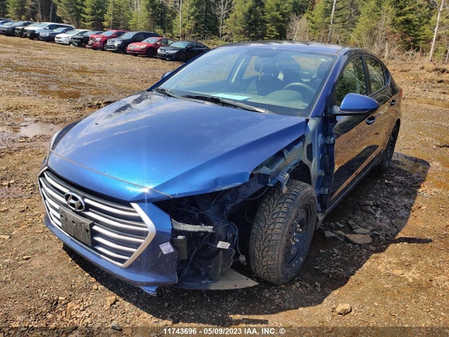 Hyundai Elantra Le 2017 5NPD74LF2HH075396 Image 3