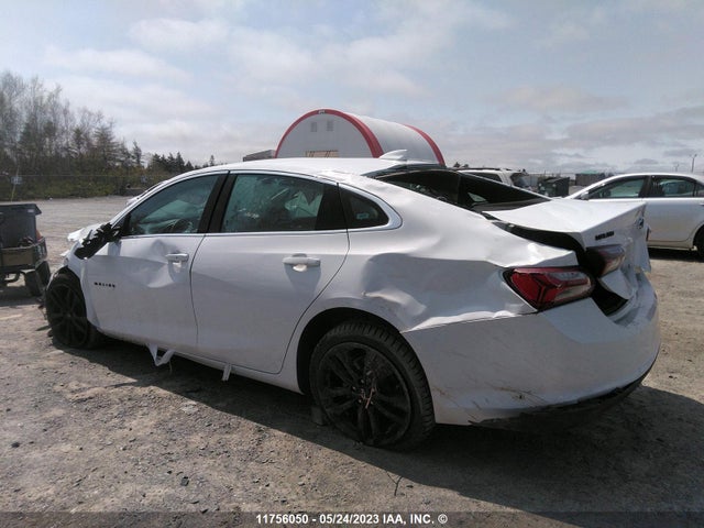Chevrolet MALIBU LT 2022 1G1ZD5ST1NF148770 Image 5