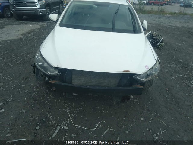 Hyundai ELANTRA GL 2017 KMHD84LF4HU397908 Image 6