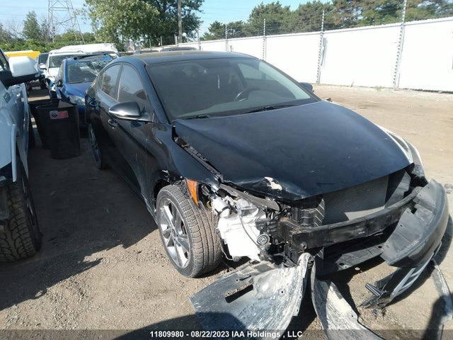 Hyundai Elantra Gls 2017 KMHD84LF6HU399773 главное изображение