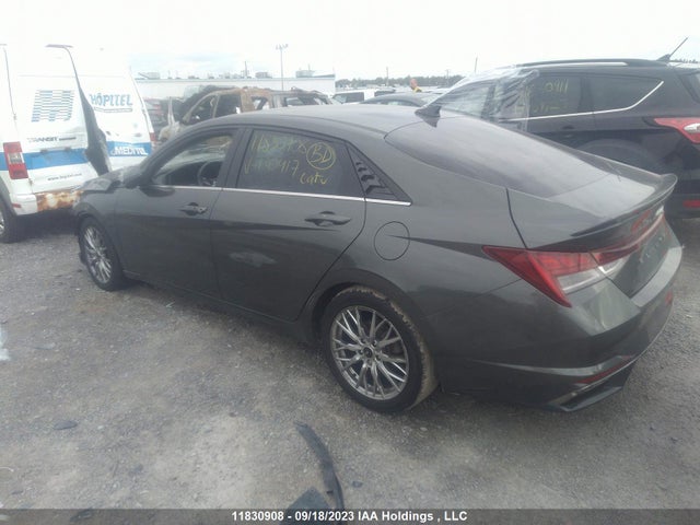 Hyundai Elantra Ultimate 2021 KMHLN4AG7MU130417 Image 3