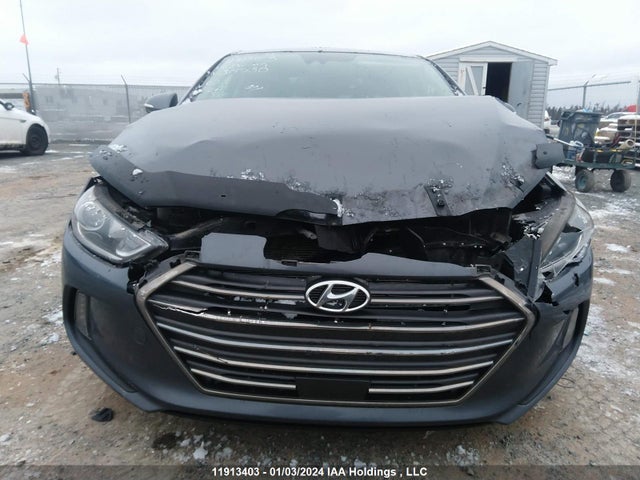 11913403 :رقم المزاد ، KMHD84LF6HU314530 vin ، 2017 Hyundai Elantra Se/value/limited مزاد بيع