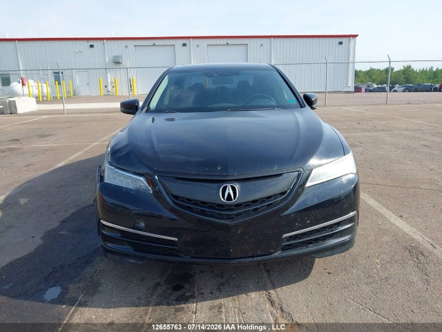 2017 Acura TLX TECH 照片 12
