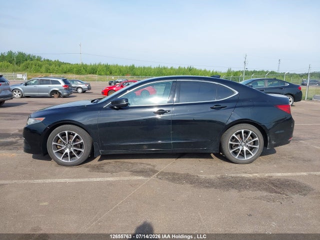 2017 Acura TLX TECH 照片 14