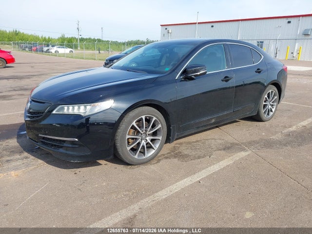 2017 Acura TLX TECH 照片 2