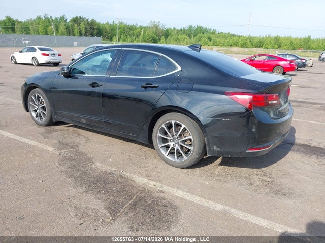 2017 Acura TLX TECH 照片 3