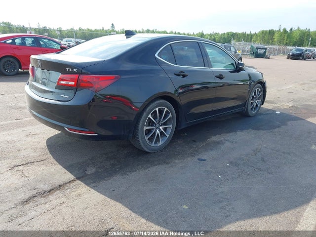 2017 Acura TLX TECH 照片 4