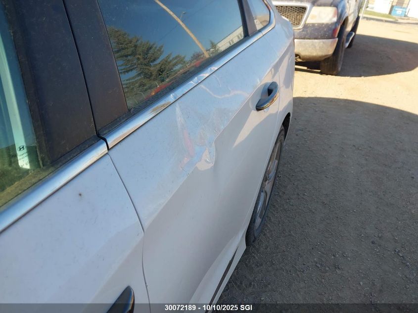 2018 Hyundai Sonata Sport/Limited/Sel VIN: 5NPE34AF1JH677800 Lot: 30072189