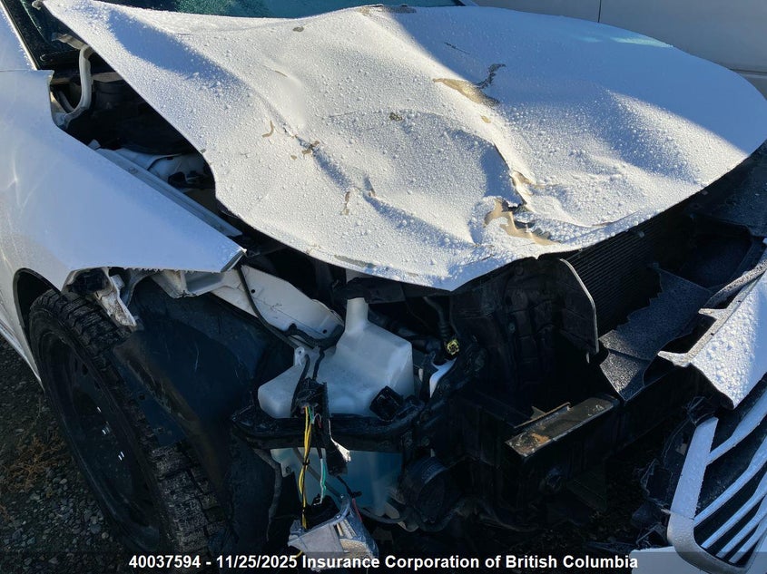 2017 Hyundai Elantra Se/Value/Limited VIN: KMHD84LF8HU100851 Lot: 40037594