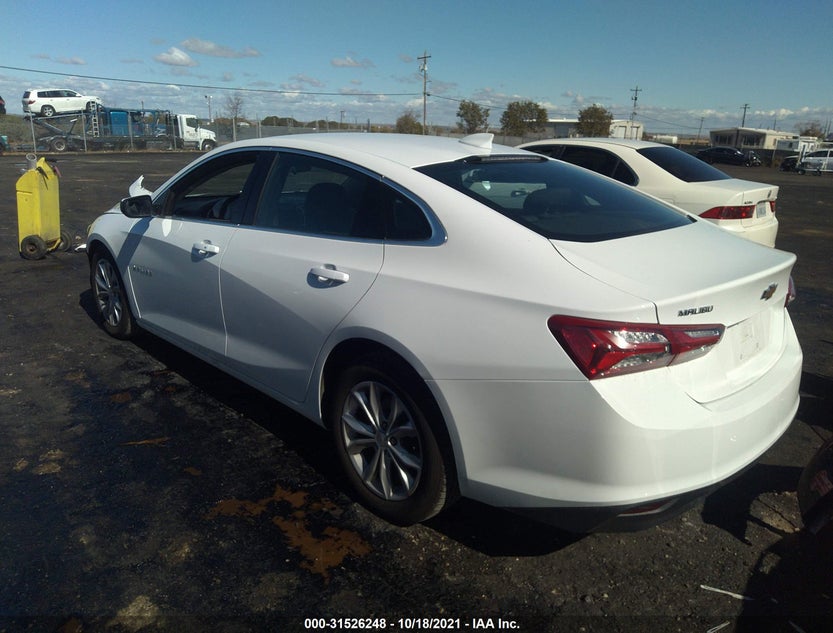 1G1ZD5ST5LF121651