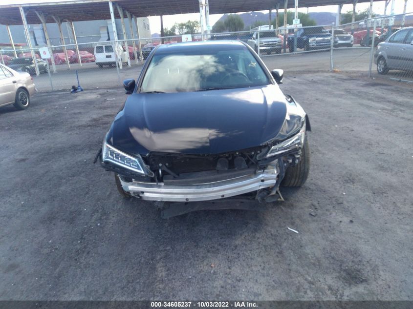 19UUB2F31HA004865 2017 Acura Tlx V6