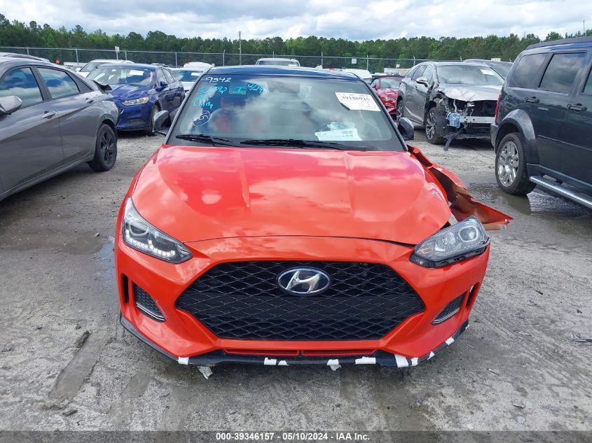 2020 Hyundai Veloster Turbo Ultimate VIN: KMHTH6AB1LU030576 Lot: 39346157