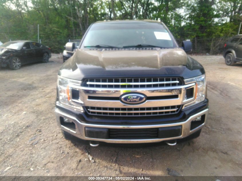 1FTEW1E51JFA92796 | 2018 FORD F-150